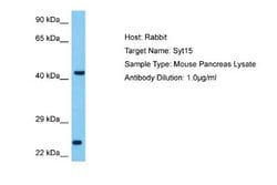 SYT15 Rabbit anti-Mouse, Polyclonal, Novus Biologicals 0.1ml; Unconjugated:Antibodies,